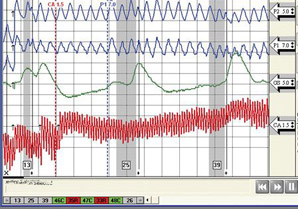 Santo Domino polygraph testing